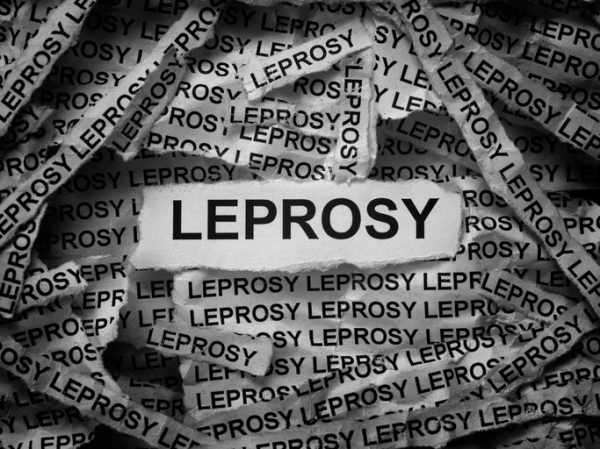 Strips of black and white newsprint with the word leprosy repeatedly spelled out